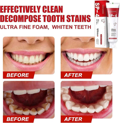 Probiotic Whitening Toothpaste (BUY 1 GET 1 FREE)